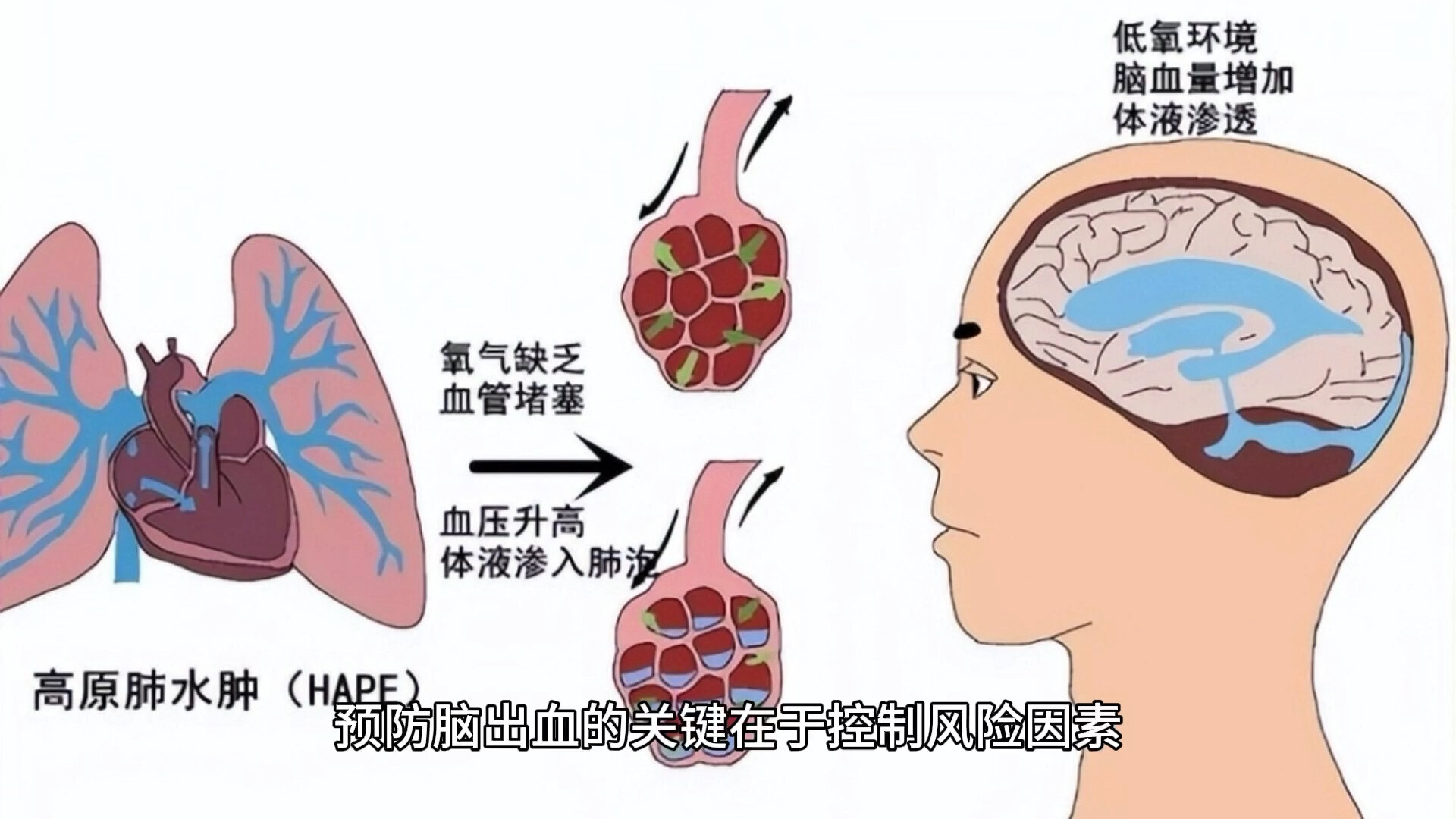 默认图片