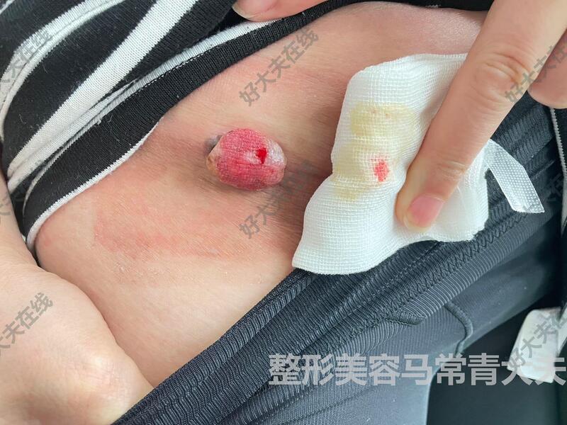 圖文圖片