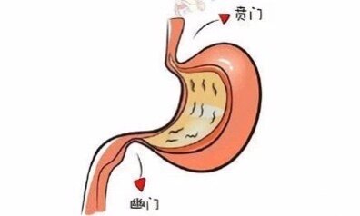 胃贲门位置图片图片