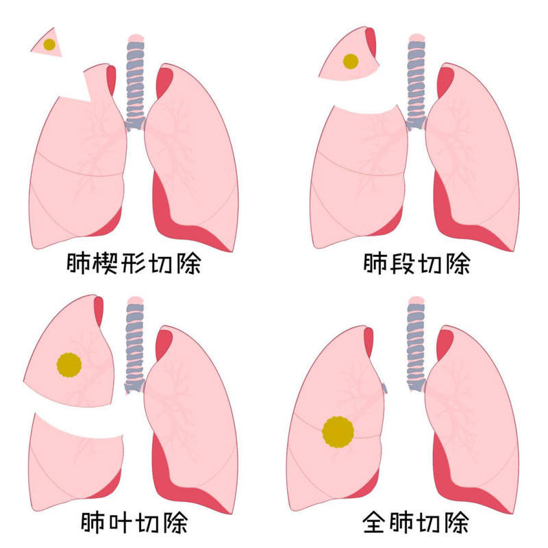 圖文圖片
