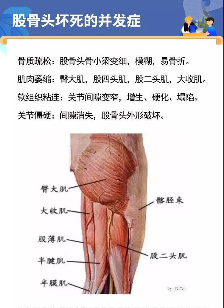 股骨内上髁位置图片