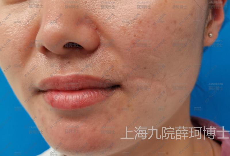 圖文圖片