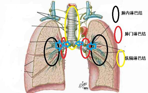 手术后肺癌淋巴结肿大 z4YBAGEeUm6AJx4_AAPMVvg6WVs321.png?_ms_=e4bd