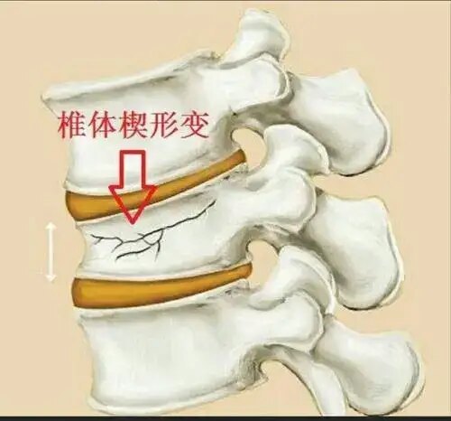 圖文圖片