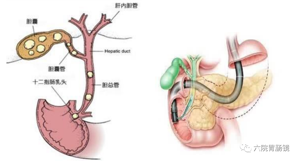 胆管和胰腺连接图片图片