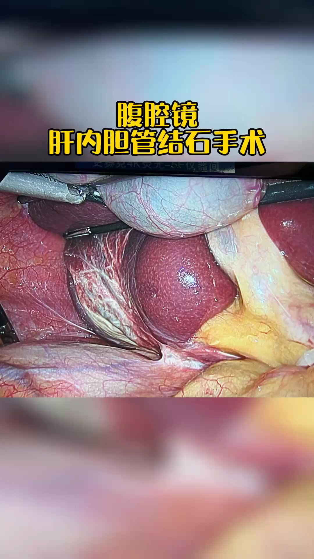 默认图片