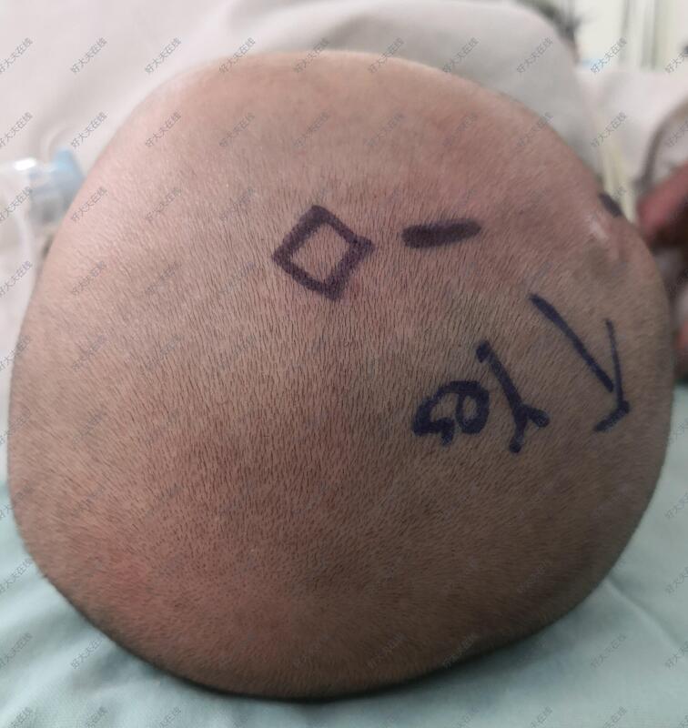 圖文圖片