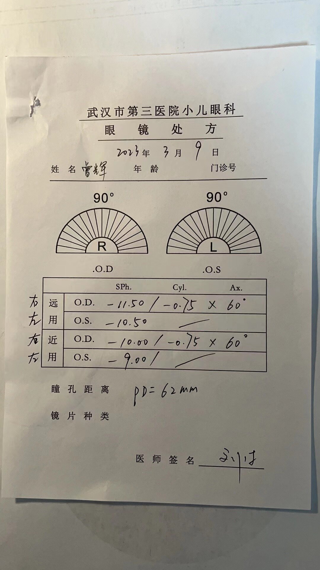 pd=62㎜左侧眼睛为主导,右侧斜视15°,pd=62㎜眼底黄斑六线