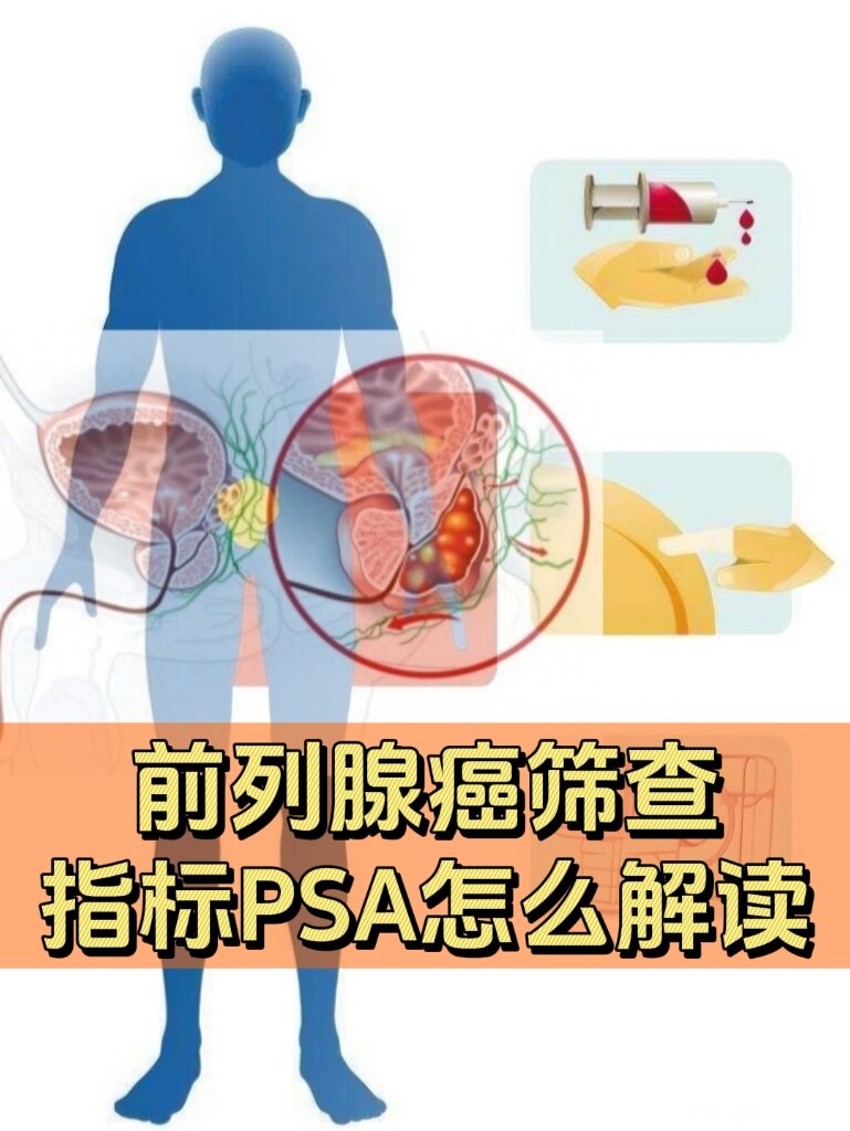 圖文圖片