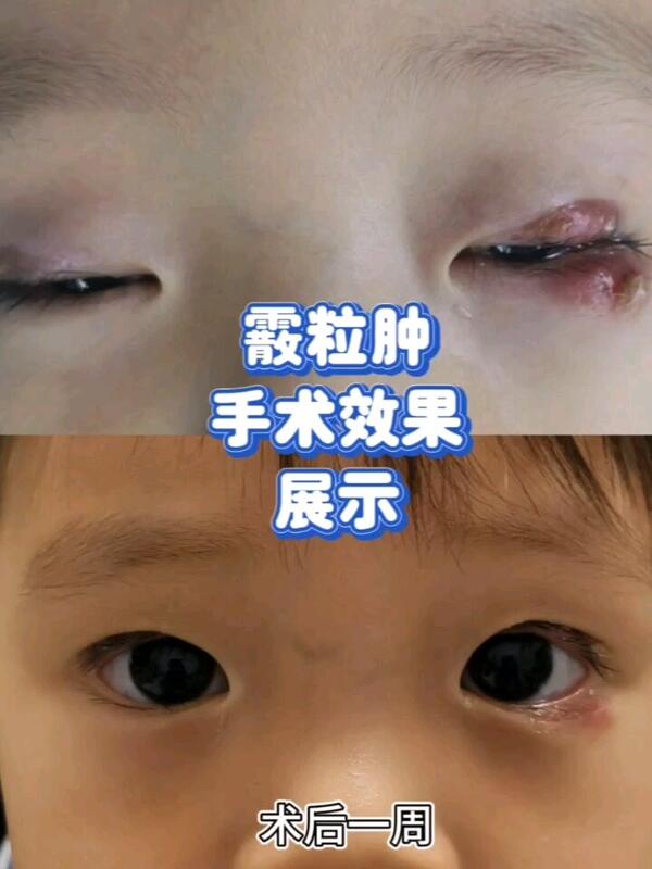 視頻封面
