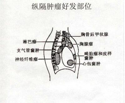 圖文圖片
