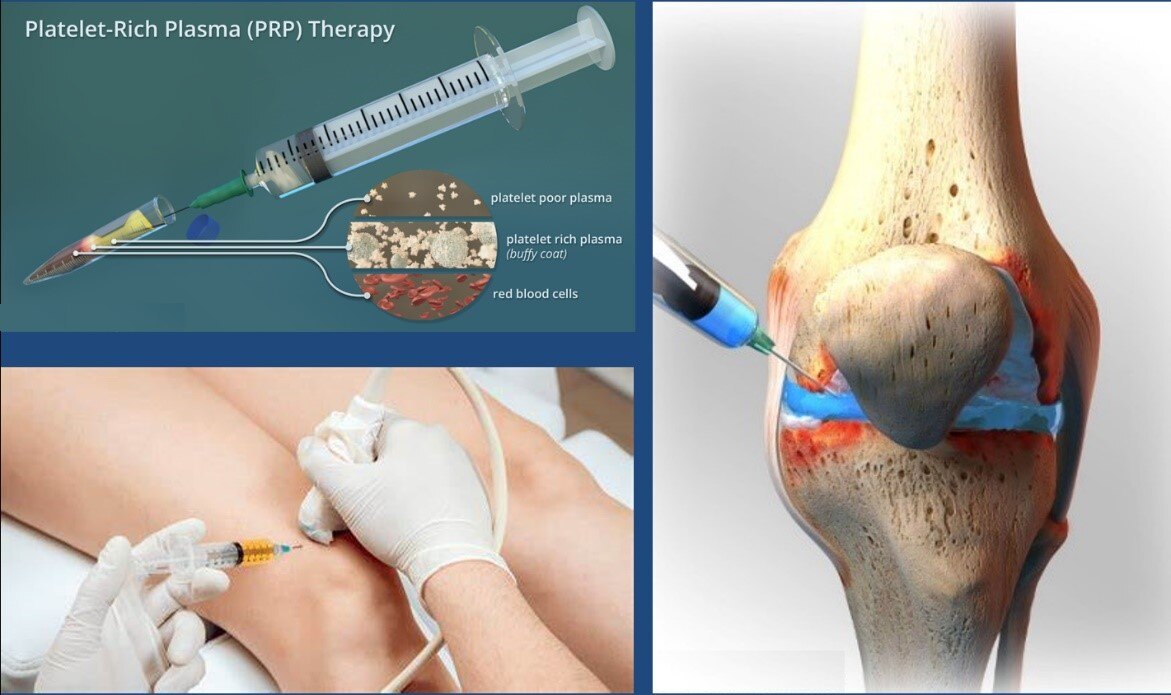 1680448179941677.jpg 1680448179941677.jpg