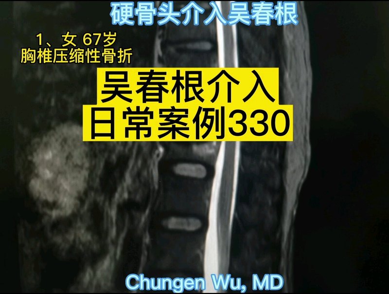 視頻封面