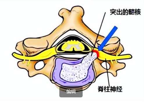 圖文圖片
