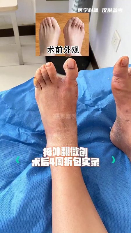 視頻封面