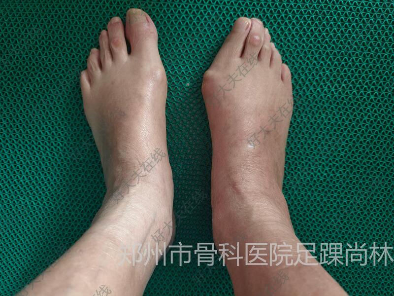 圖文圖片