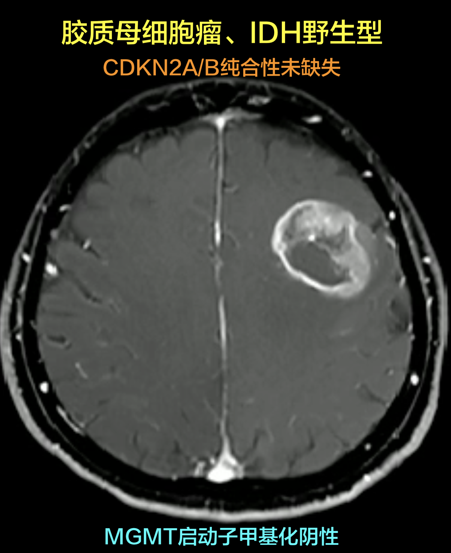 圖文圖片