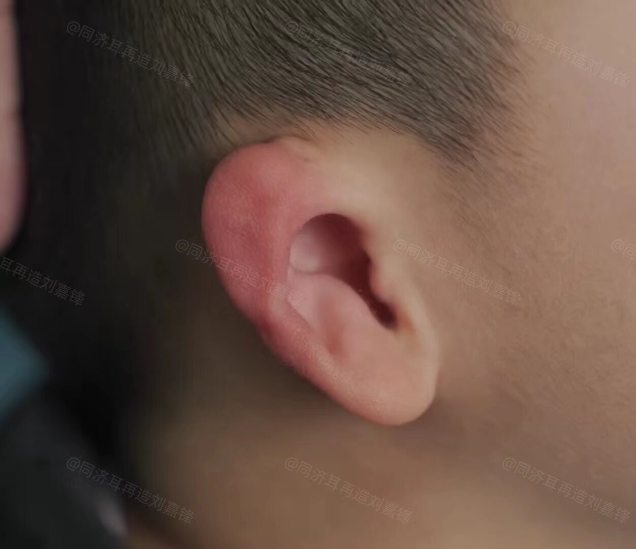 圖文圖片