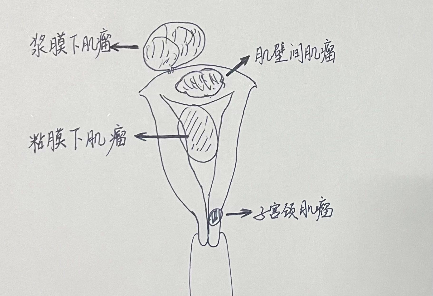 圖文圖片