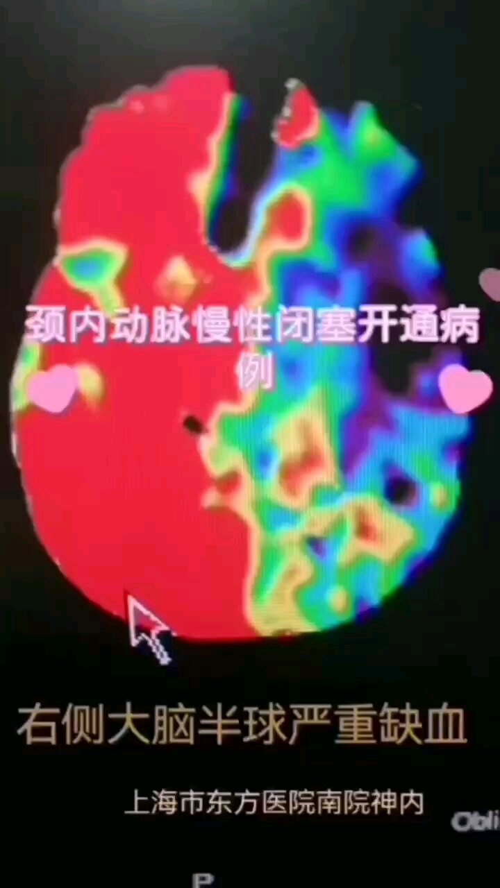 默认图片