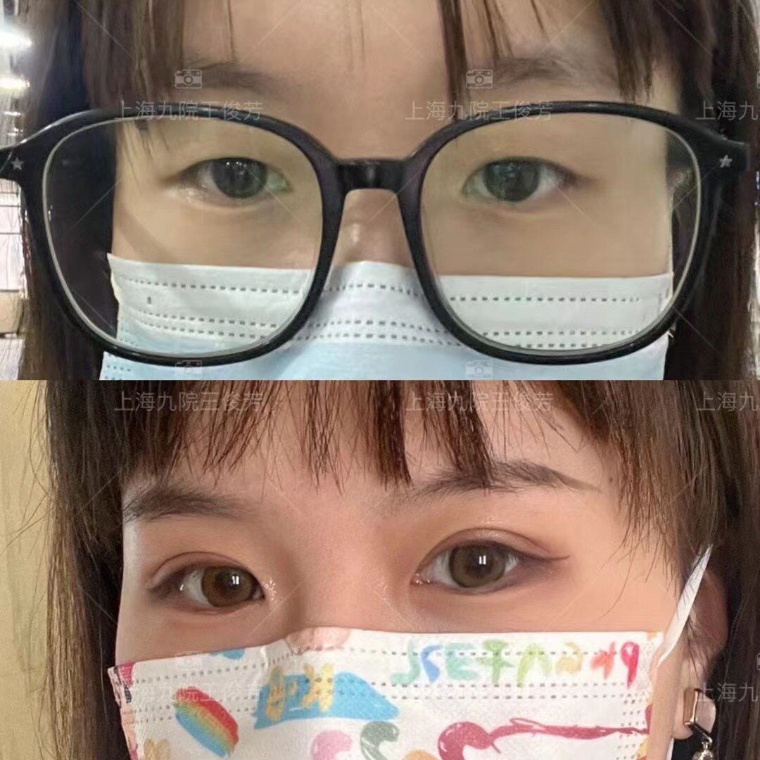 圖文圖片