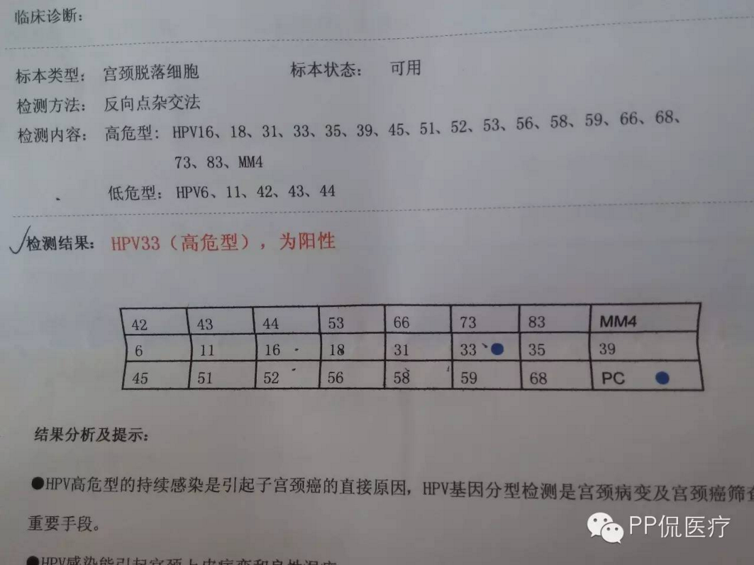 为什么我的hpv检测报告和别人不一样 宫颈癌 检查