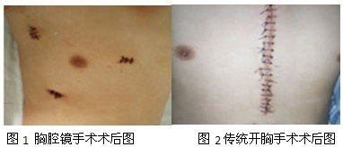 暂无
