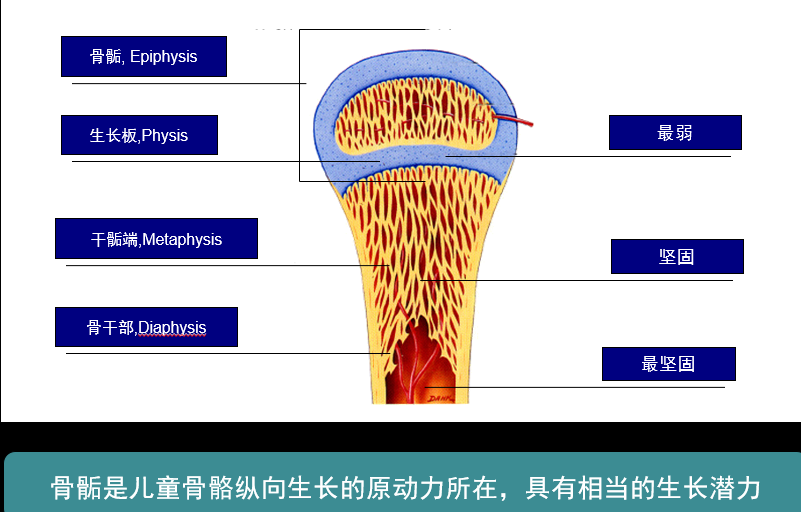 图1儿童长骨骨骺的解剖示意图图2手术前x片图3手术前正面观图4手术前