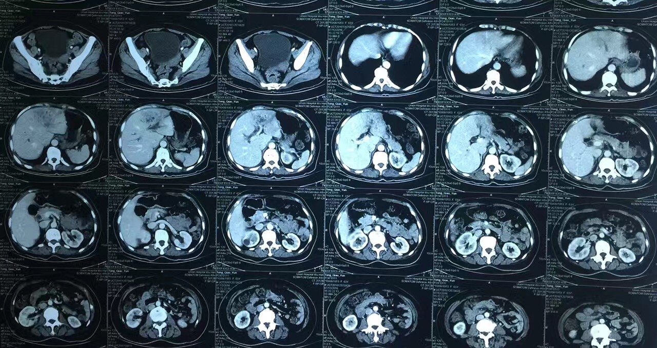 认识"肝岛" - 好大夫在线