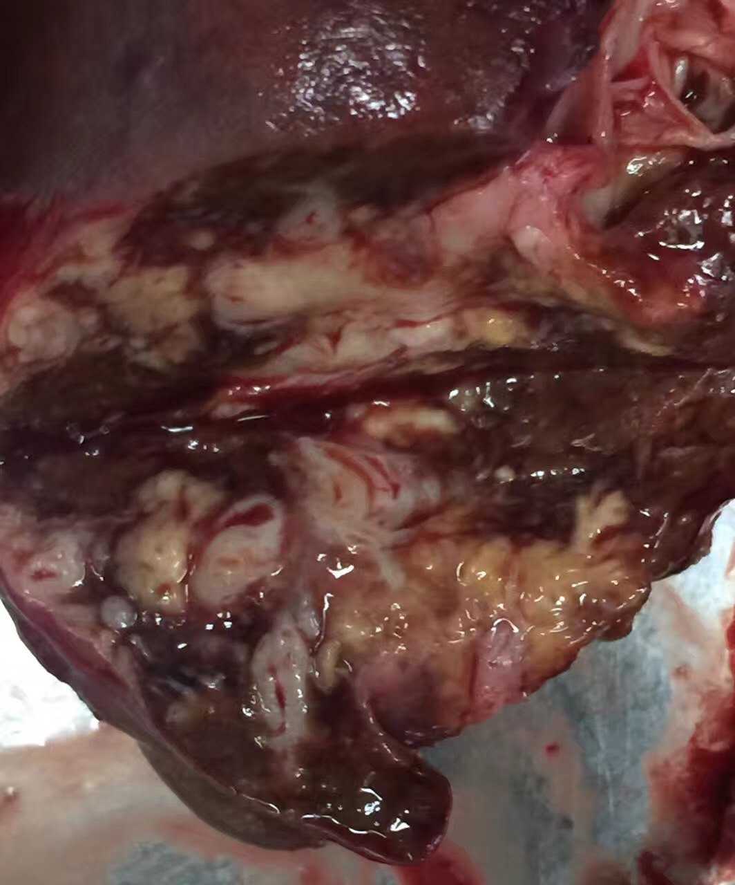 认识"肝岛" - 好大夫在线