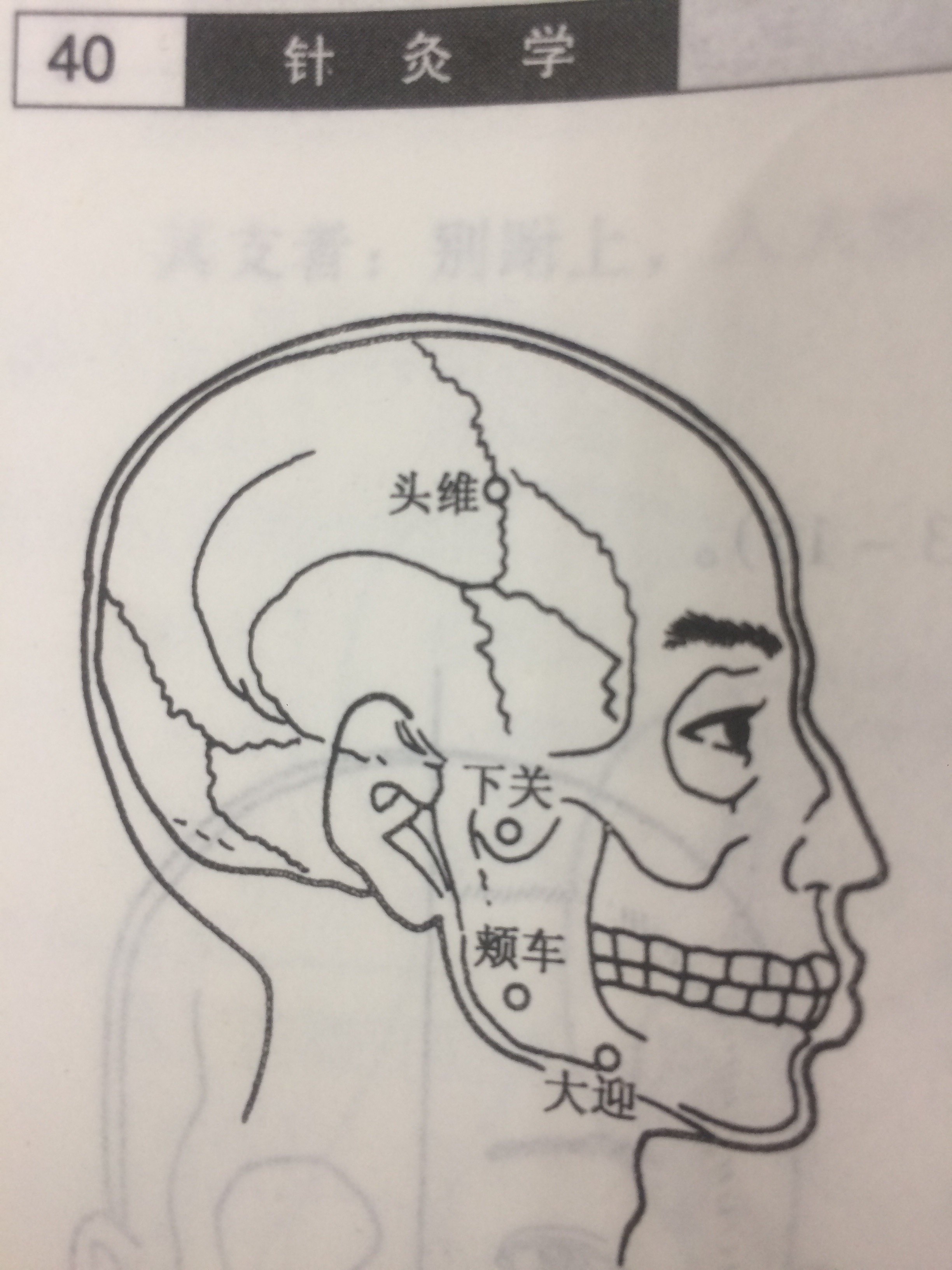 头维针刺治疗经期头痛