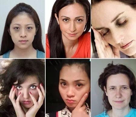 你知不知道"黑眼圈"有两种颜色?