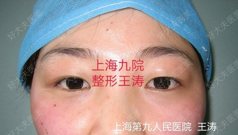 圖文圖片