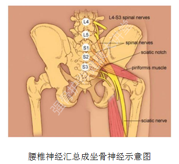坐骨神经痛_发病原因_症状表现 - 好大夫在线