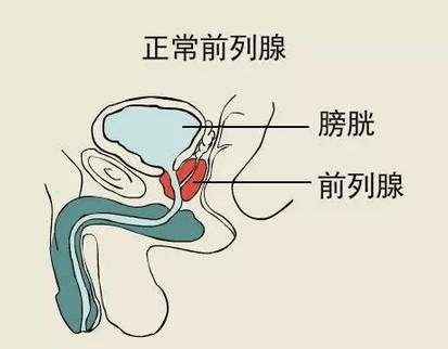 前列腺炎腰痛的位置图图片