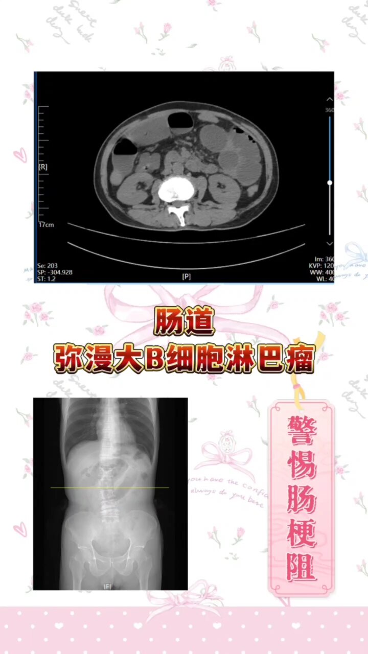 默认图片