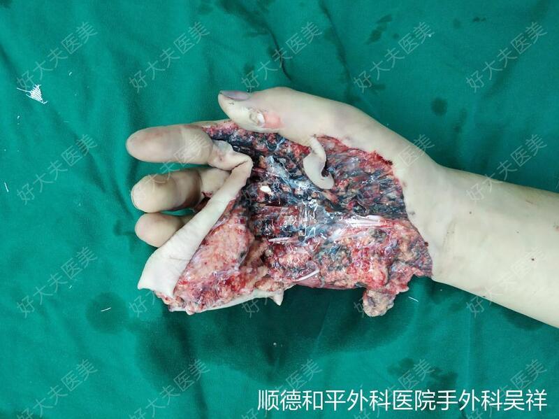 圖文圖片
