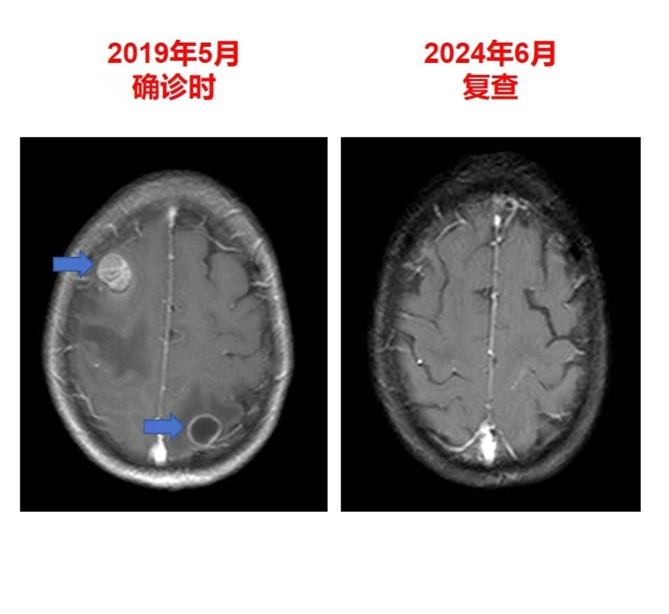 圖文圖片