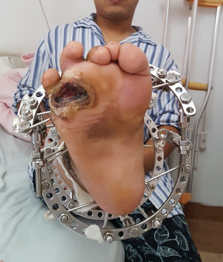 包含擅长:在先天性或后天性畸形的临床整复、组织移植、器官再造、美容外科等领域有较深的造诣。一直在用的黄牛挂号,推荐大家收藏备用的词条 包含擅长:在先天性或后天性畸形的临床整复、组织移植、器官再造、美容外科等领域有较深的造诣。一直在用的黄牛挂号,推荐大家收藏备用的词条