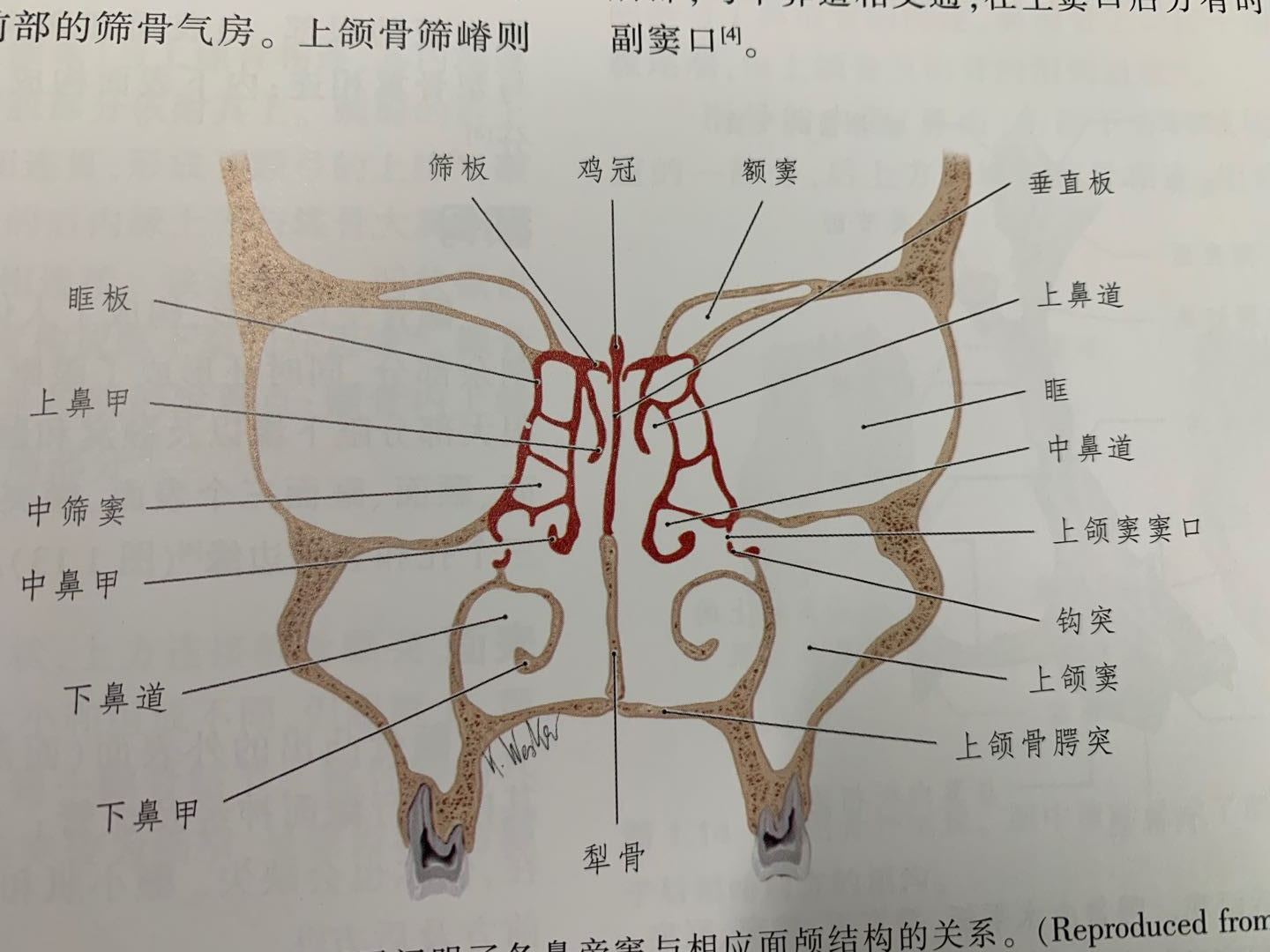 骨性鼻腔解剖图图片