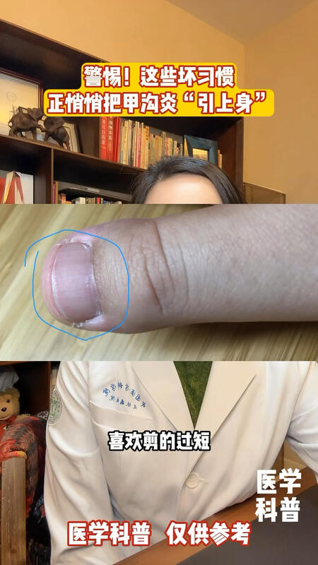 視頻封面