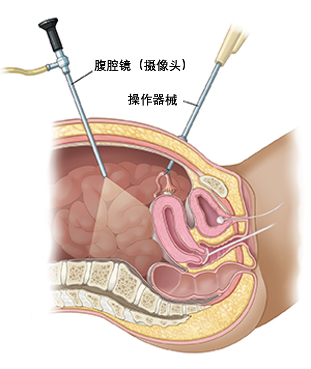 圖文圖片