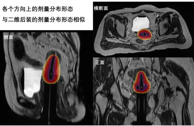 圖文圖片