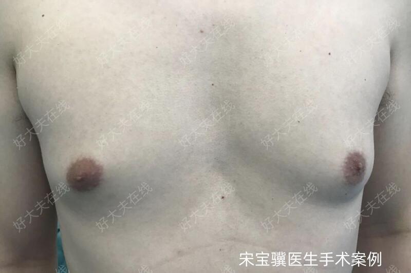 圖文圖片
