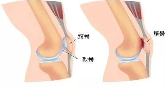 圖文圖片