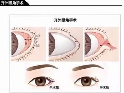 圖文圖片