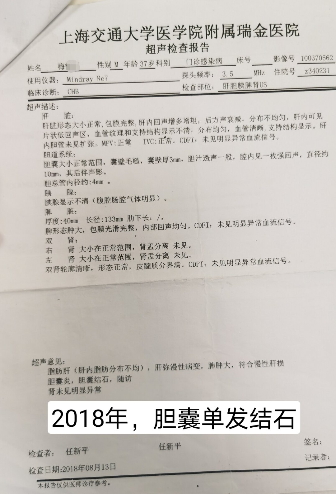 胆囊丝毫都没有张力,术中只能把胆囊切掉,术后切开胆囊见胆囊内可见白