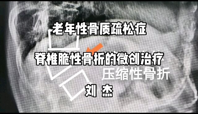 視頻封面