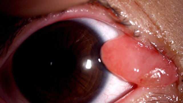 1601294551937704.jpeg 眼周.jpeg