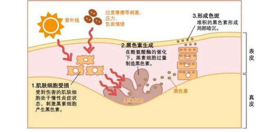 1602336067155182.jpg 各种各样的斑1.jpg